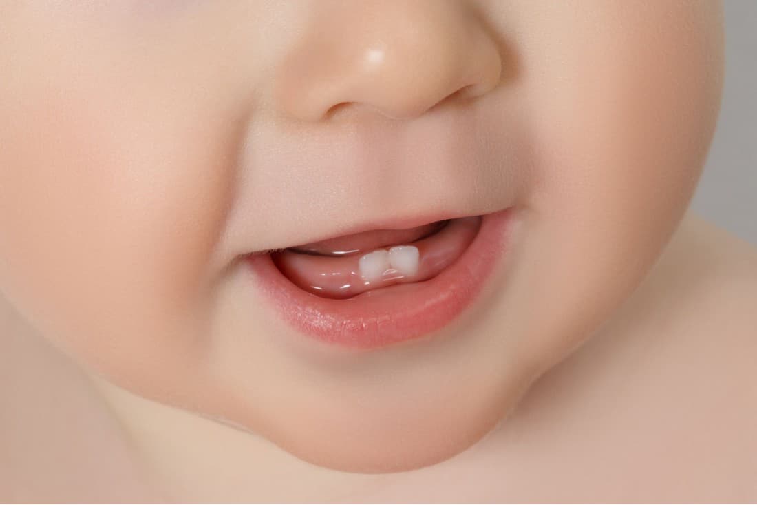 primi denti del bambino
